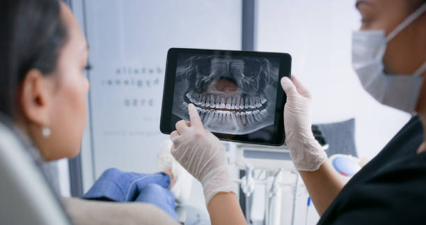 Licensed Dental Implants service in Dunkirk, NY - Smile Center Dentistry